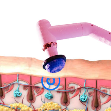 Full Body Gun Massager With Hot and Cold Therapy (HCM)