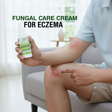 Fungal Care Cream For Eczema (BCER)