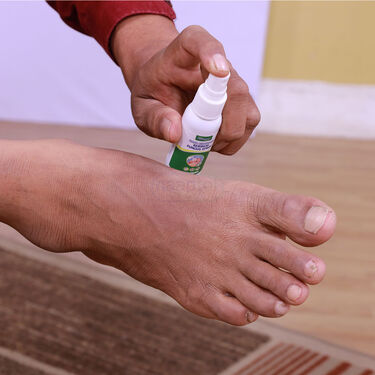Anti Fungus & Bacteria Foot Spray (CD-FCOS)