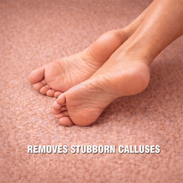 Dead Skin Remover For Feet (RFF6)