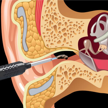 Ear Wax Cleaner with Camera (EDC3)
