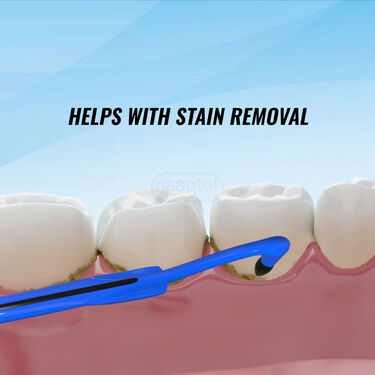 Teeth Stain Cleaner (ETSE2)