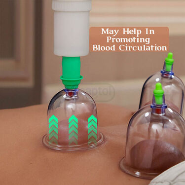 Cupping Therapy For Pain Relief (CT02)