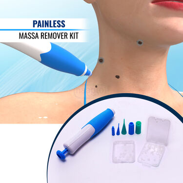 Painless Massa Remover Kit (WR3)