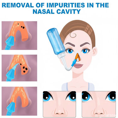 Nasal Wash Bottle (NWB3)