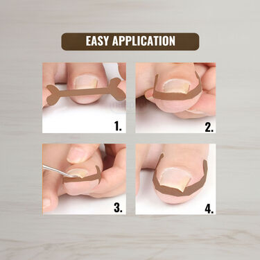 Toenail Corrector Patch Pack of 20 (FCR2)