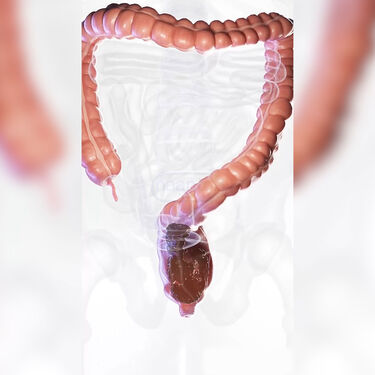 Toilet Squat Stool (PF11)