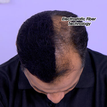 Instant Hair Volume Fiber (HCVF)