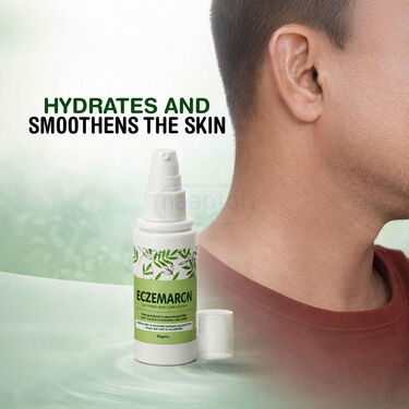 Fungal Care Cream For Eczema (BCER)