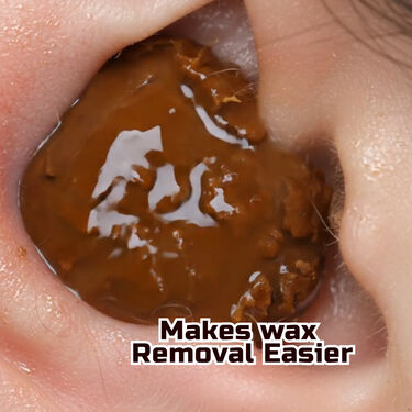 Gentle & Safe Ear Wax Remover Spray (CD-BCES)