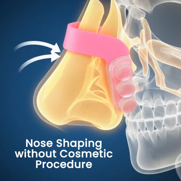 Silicone Nose Shaper Clip B1G1 (2NS)