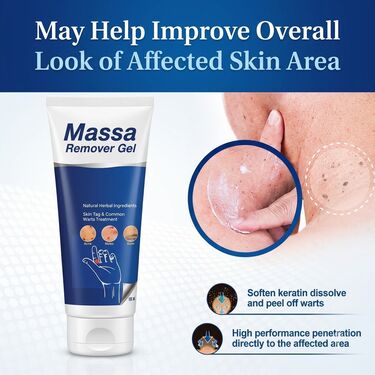 Massa Remover Gel (BCMR)
