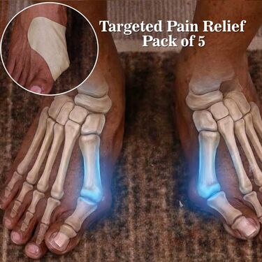 Foot Bunion Care Patch - Pack of 5 (CD-FTCB)
