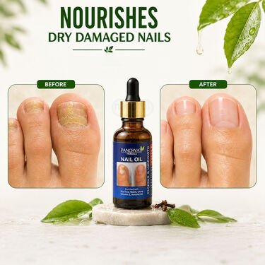 Anti Fungus Nail Care Oil (FTCR5)