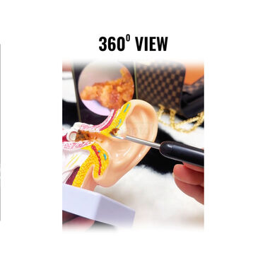 Ear Wax Cleaner with Camera (EDC3)