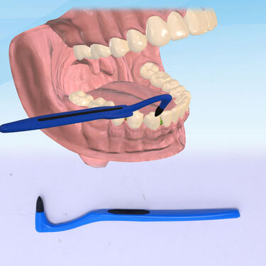 Teeth Stain Cleaner (ETSE2)