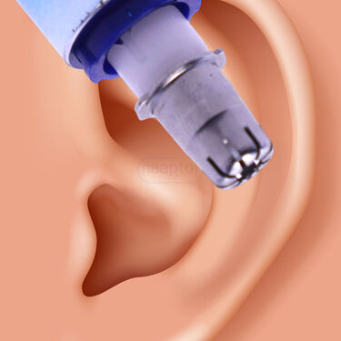 Painless Nose & Ear Hair Trimmer (NHC7)